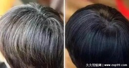 治疗白发的方法(怎样治疗白发最有效的方法)