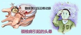 颈椎病眩晕治疗方法(颈椎病眩晕治疗方法)