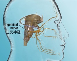 三叉神经痛治疗方法(三叉神经痛怎么根治)
