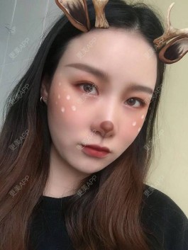 缩小鼻翼的方法(缩小鼻翼的方法有哪些视频)