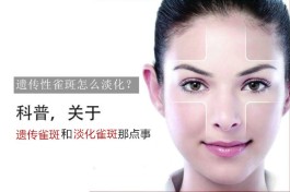 去雀斑最好的方法(去雀斑最好的方法 目前最有效的)