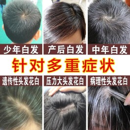 少年白发变黑的方法(少年白发变黑简单方法)
