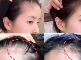 八个方法让头发变浓密(八个方法让头发变浓密常梳头能治疗焦虑症吗)