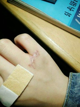 去疤的方法(去疤的方法有哪些呢)