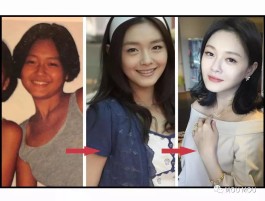 大s美白方法(大s变白方法)