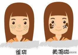 祛斑好方法(祛斑好方法是什么)