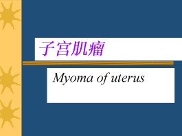 子宫肌瘤的治疗方法(子宫肌瘤的治疗方法有哪些论述题)