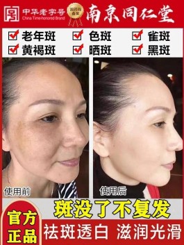 去老年斑的方法(偏方去老年斑的方法)