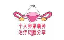 卵巢囊肿怎么治疗最好方法(右侧卵巢囊肿怎么治疗最好方法)