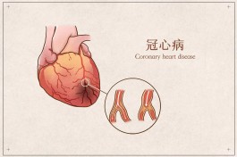 冠心病最佳治疗方法(冠心病最佳治疗方法吃什么药)
