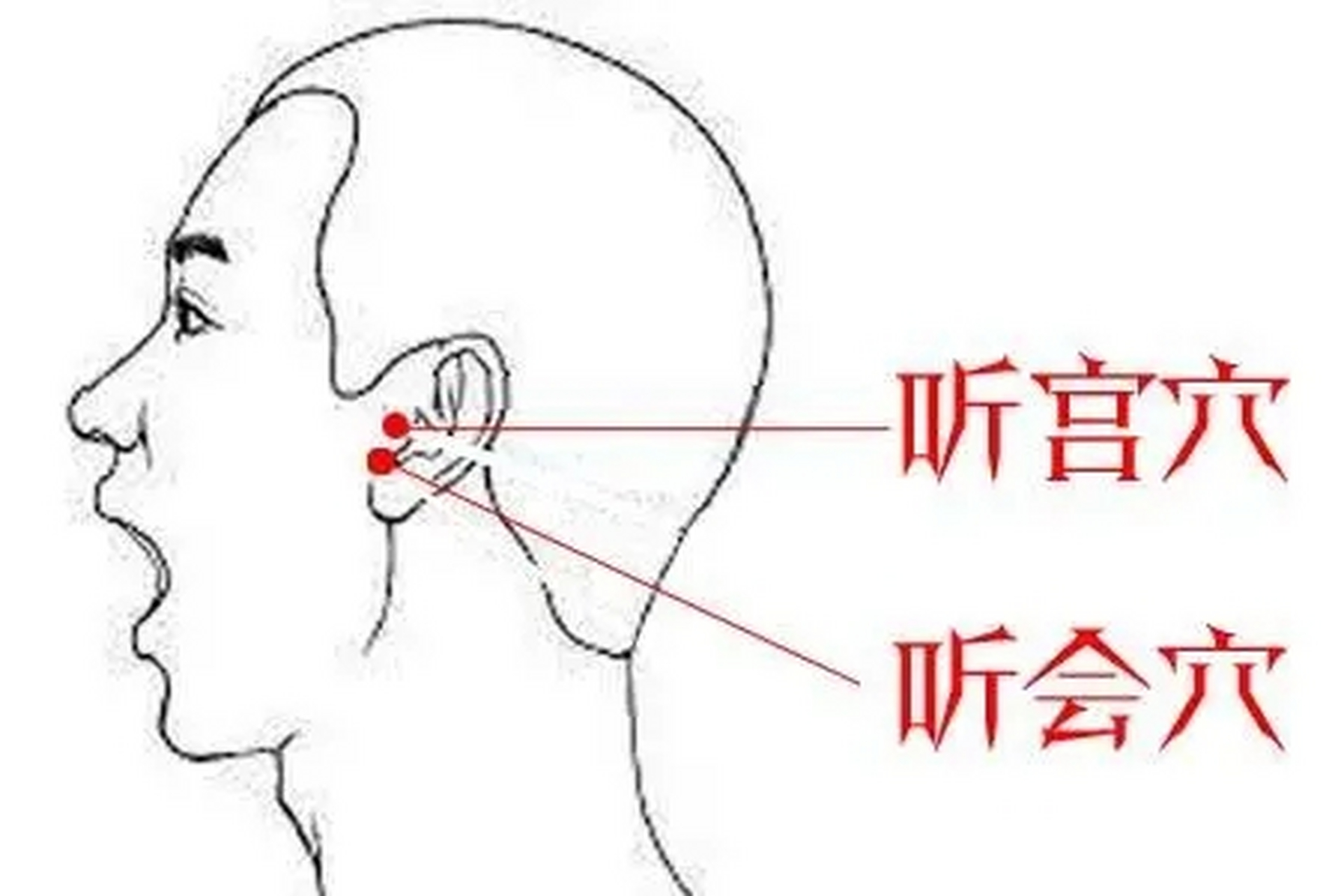 听会听宫耳门位置图图片