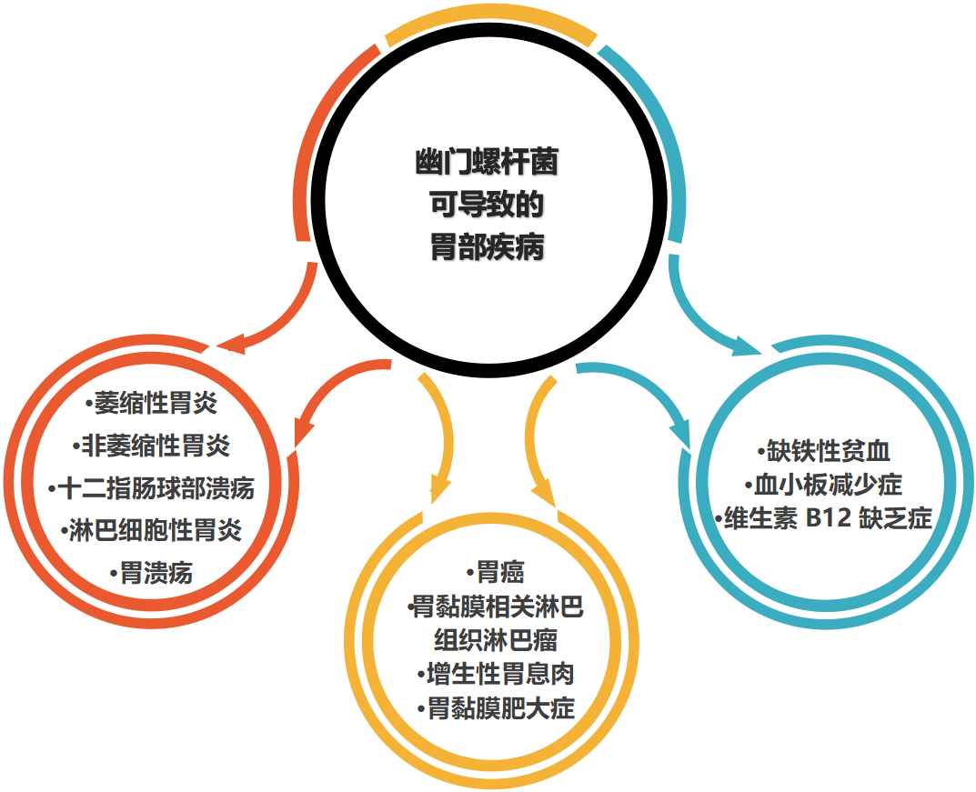 幽门螺旋杆菌最好的治疗方法(幽门螺旋杆菌最好的治疗方法用量) 幽门螺旋杆菌最好的治疗方法 第1张